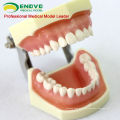 DENTAL04 (12563) Modelo anatômico Modelo Estudo Dental Modelos com goma macia